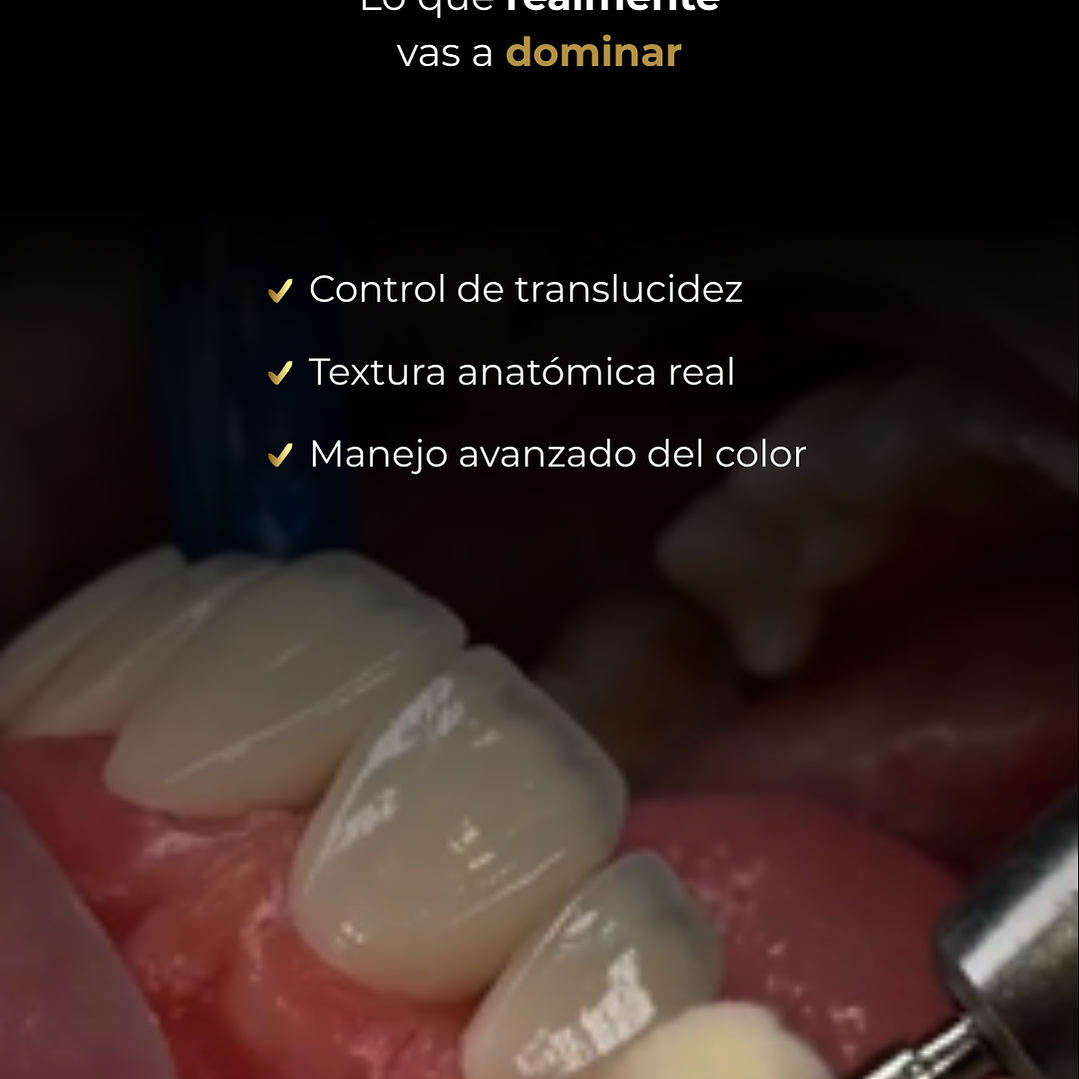 Stratify Internacional: Diseño de Sonrisa en Carillas de Resina Estratificadas 5