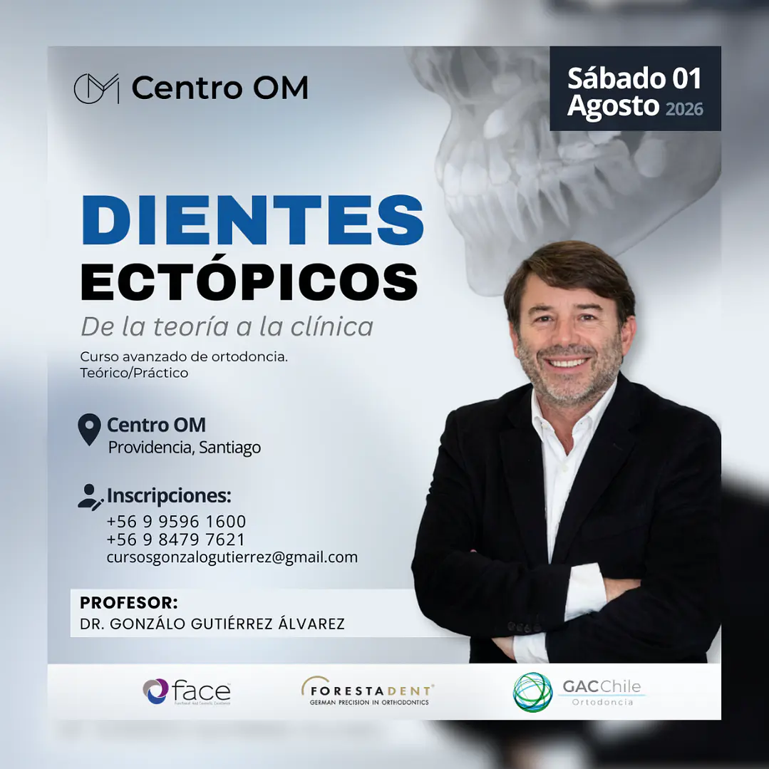 Dientes Ectópicos: De la teoría a la clínica 1