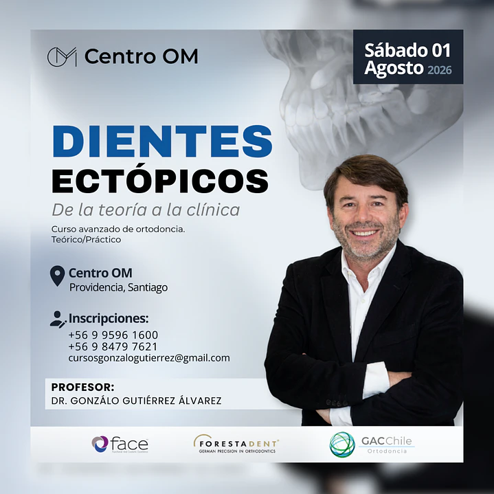 Dientes Ectópicos: De la teoría a la clínica 1