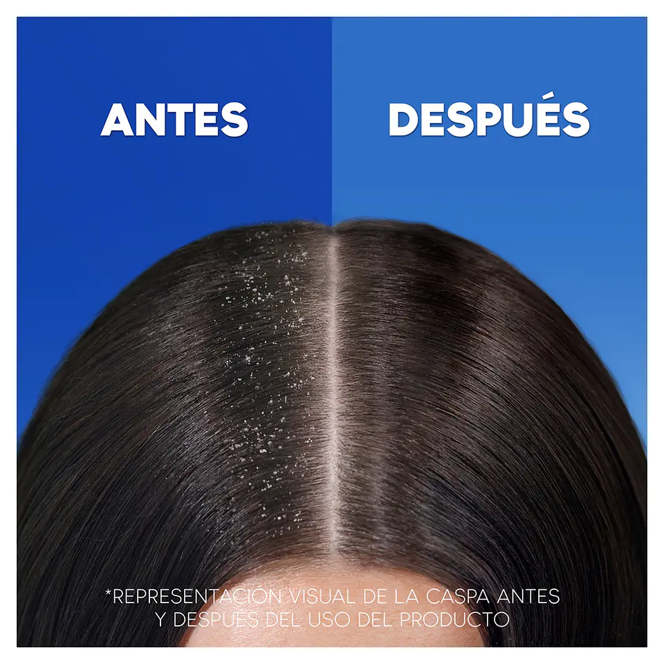 Champú anticaspa Menthol Fresh efecto refrescante 8