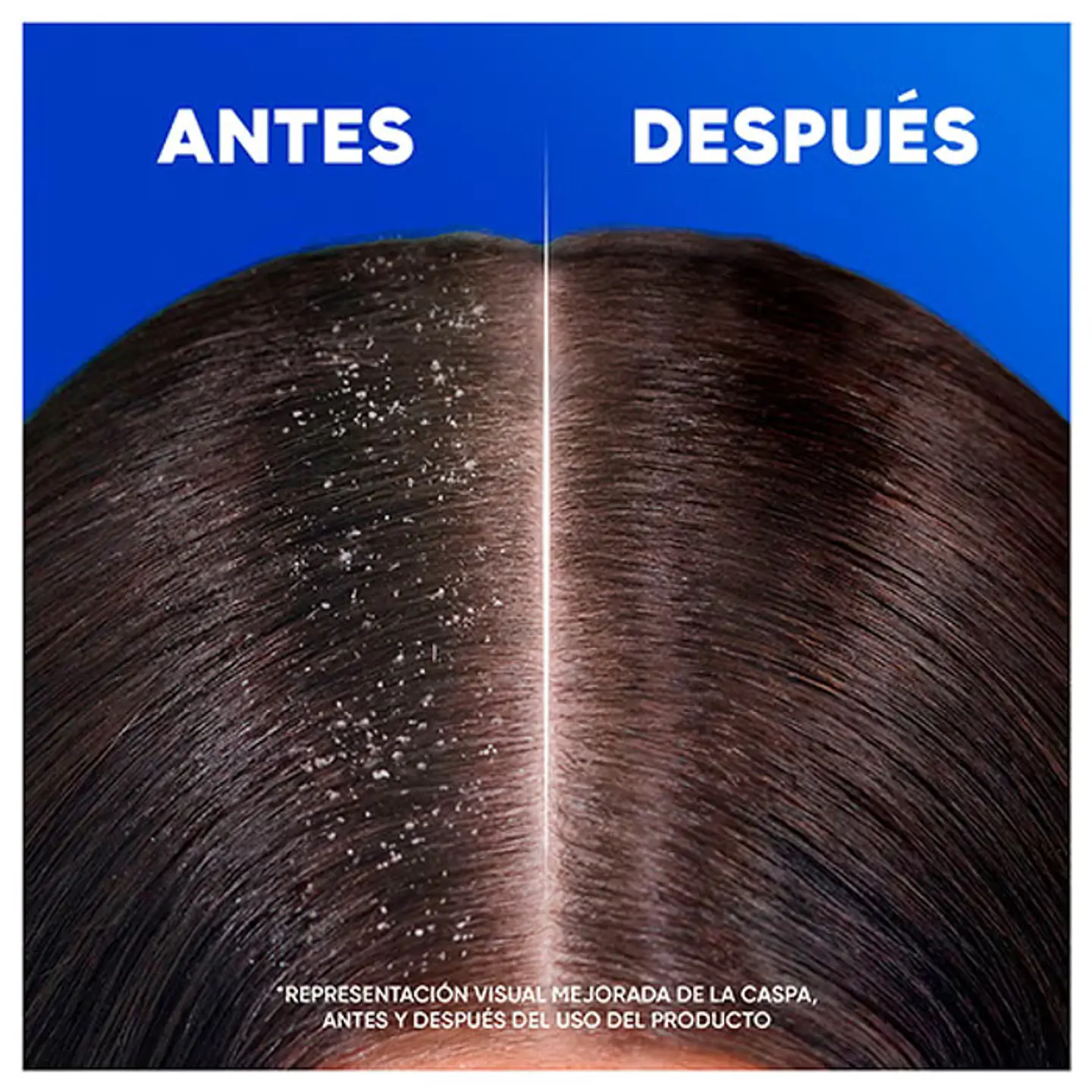 Champú anti-caspa cítrico 8
