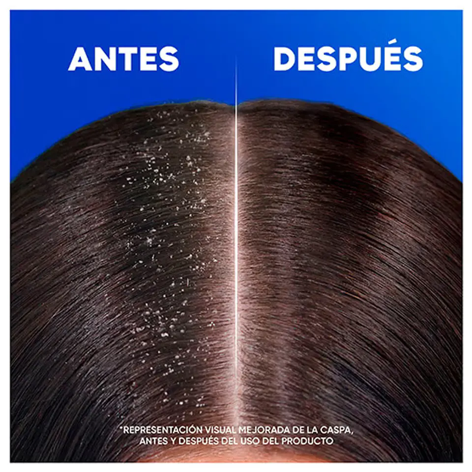 Champú anti-caspa cítrico 8