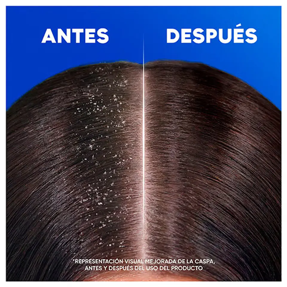 Champú anti-caspa mentol refrescante 6