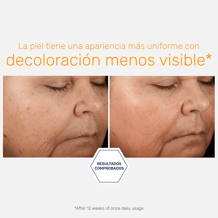 Vitamina C. Serum Iluminador - Potente Aclarante, 15 ml- 5