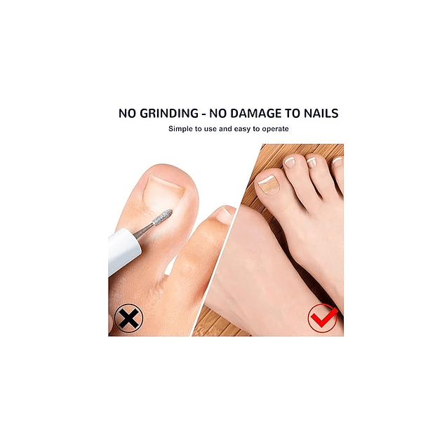 Parche Adhesivo Corrector De Uñas Encarnadas X50uni  2