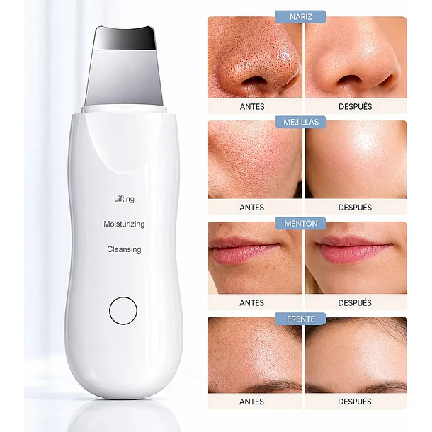Espátula Ultrasónica Facial Limpiador De Poros y Puntos Negros 6