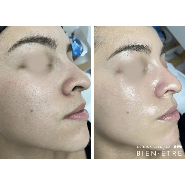 Plan anual de Limpiezas faciales