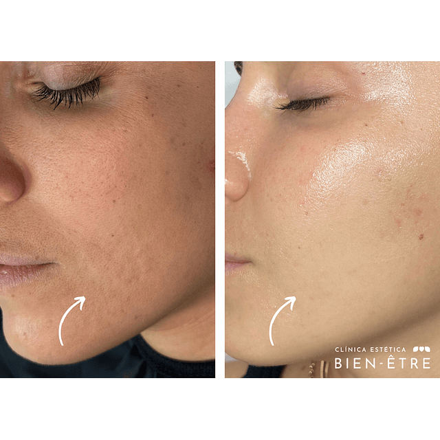 Plan Vitaminas Glow Natural (4 sesiones)