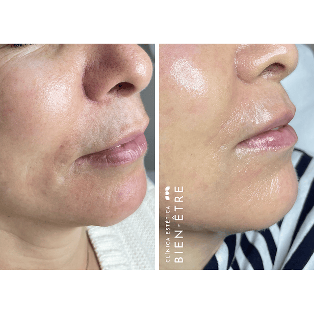 Plan Vitaminas Glow Natural (4 sesiones)