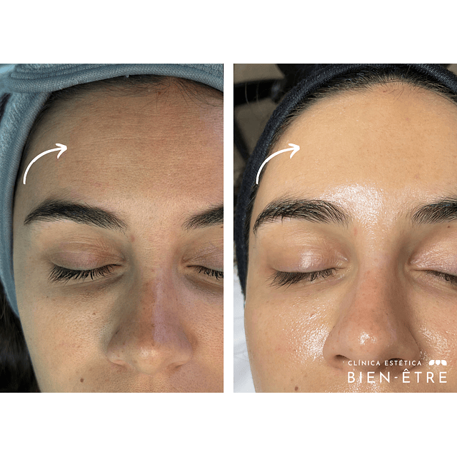 Plan Vitaminas Glow Natural (4 sesiones)