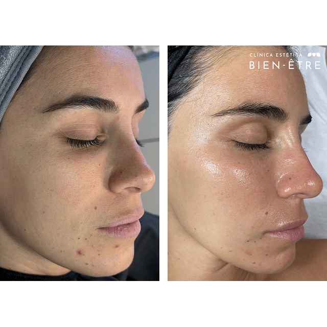 Plan Vitaminas Glow Natural (4 sesiones)