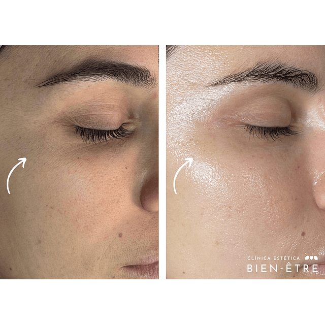 Plan Vitaminas Glow Natural (4 sesiones)