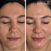 Limpieza Facial Embarazadas