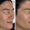 3x Limpieza Facial Embarazadas