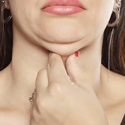 ADIÓS PAPADA (enzimas + radiofrecuencia)