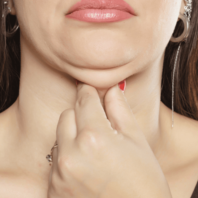 ADIÓS PAPADA (enzimas + radiofrecuencia)