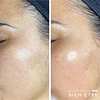 Renovación Total Peeling de Algas