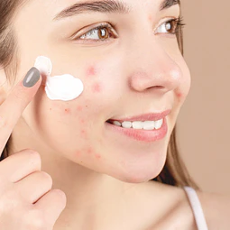 3x Limpieza Facial Acné - pieles acneicas
