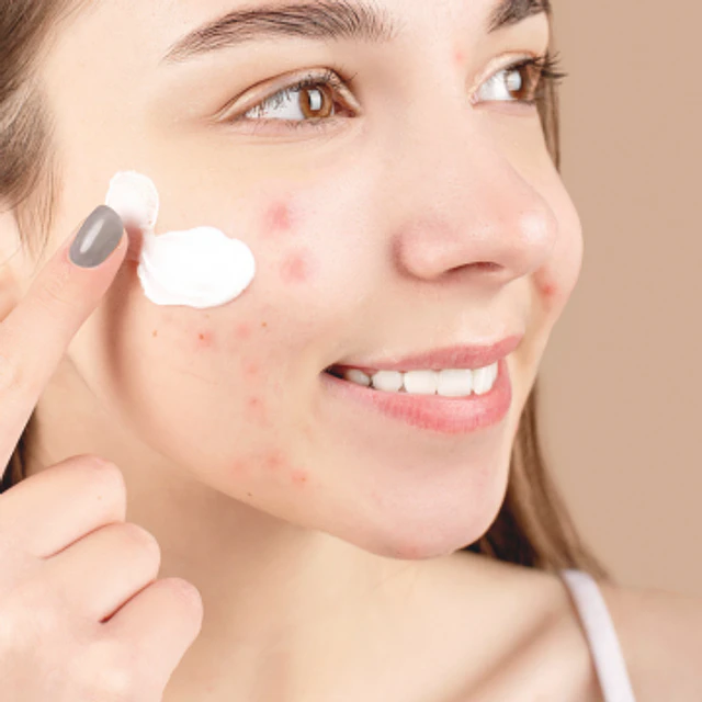 3x Limpieza Facial Acné - pieles acneicas