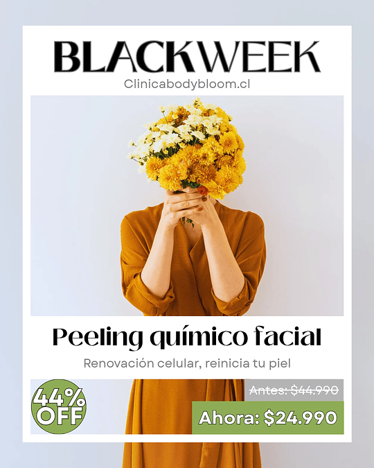 Peeling químico facial - 1 sesión