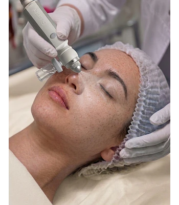 Limpieza Facial Peel Glow