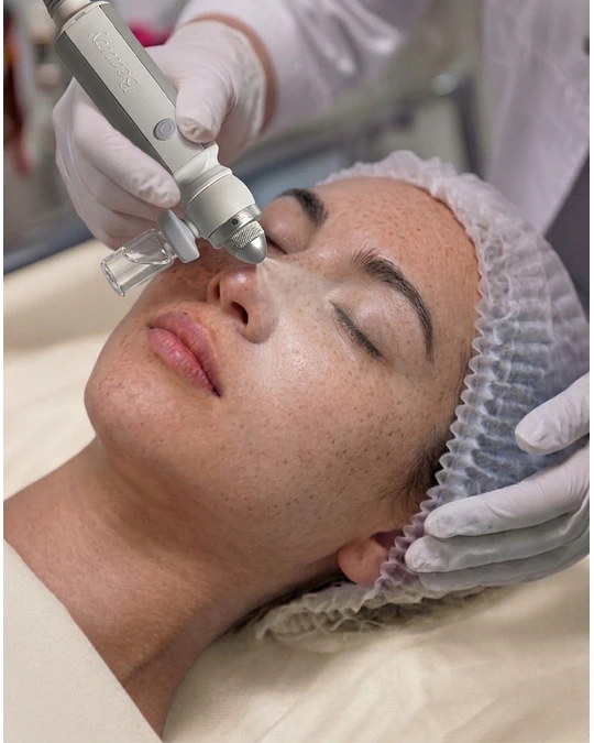 Limpieza Facial Peel Glow