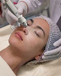 Limpieza Facial Peel Glow