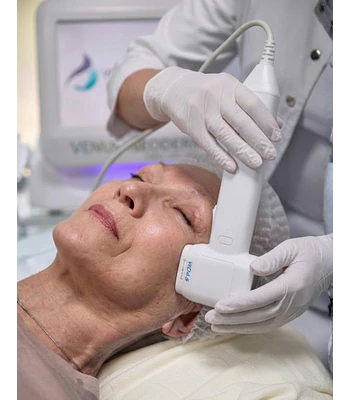 Hifu 12D Full Face - 2 sesiones