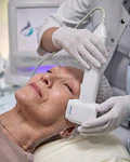 Hifu 12D Full Face - 2 sesiones
