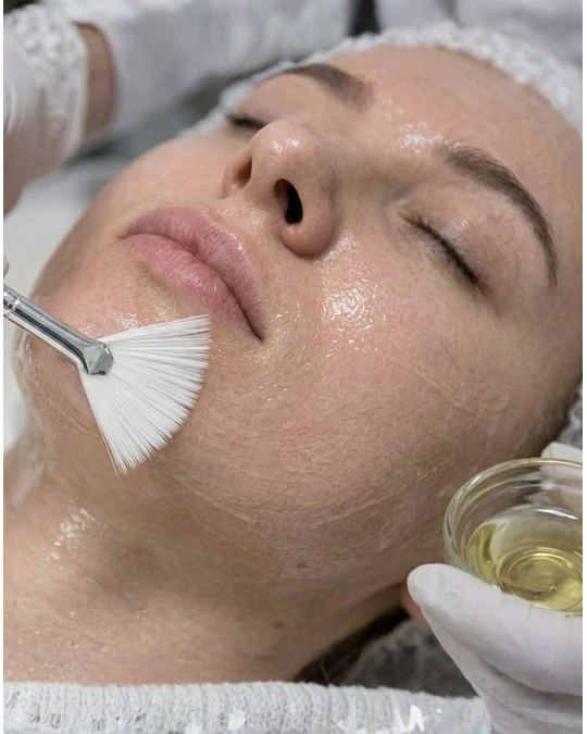Peeling - Despigmentante e iluminador