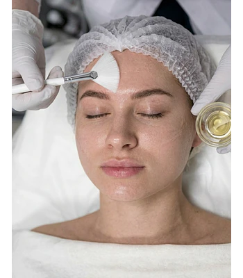 Peeling - Arrugas, cicatrices y acné