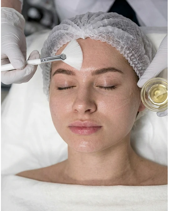 Peeling - Arrugas, cicatrices y acné