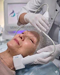 Hifu 12D Papada y cuello anterior - 3 sesiones