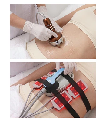Full Reductivo (Body Sculpt, Cavitación, Radiofrecuencia y Lipoláser)