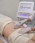 Hifu 12D Corporal - 2 sesiones