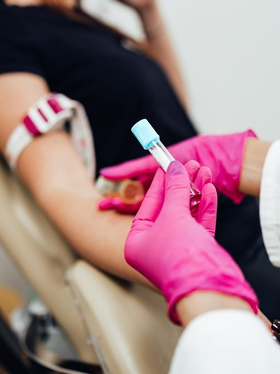 Plasma rico en plaquetas  3