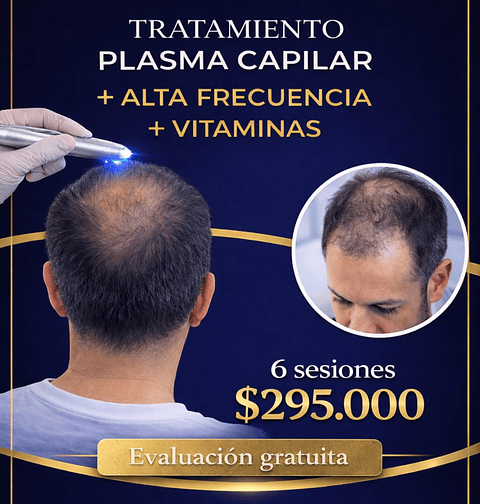 Plasma rico en plaquetas 