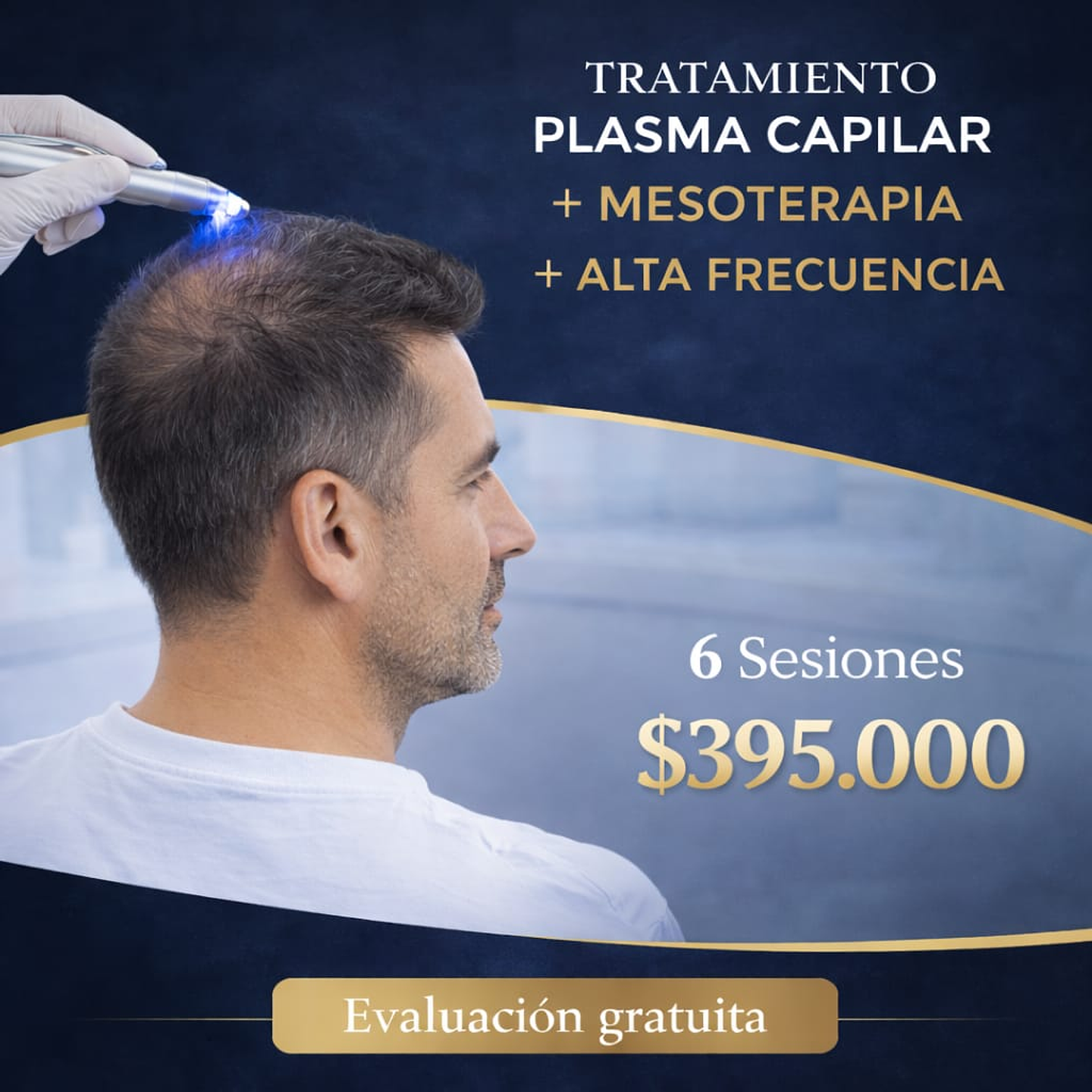 Tratamiento combinado con Mesoterapia Capilar  1