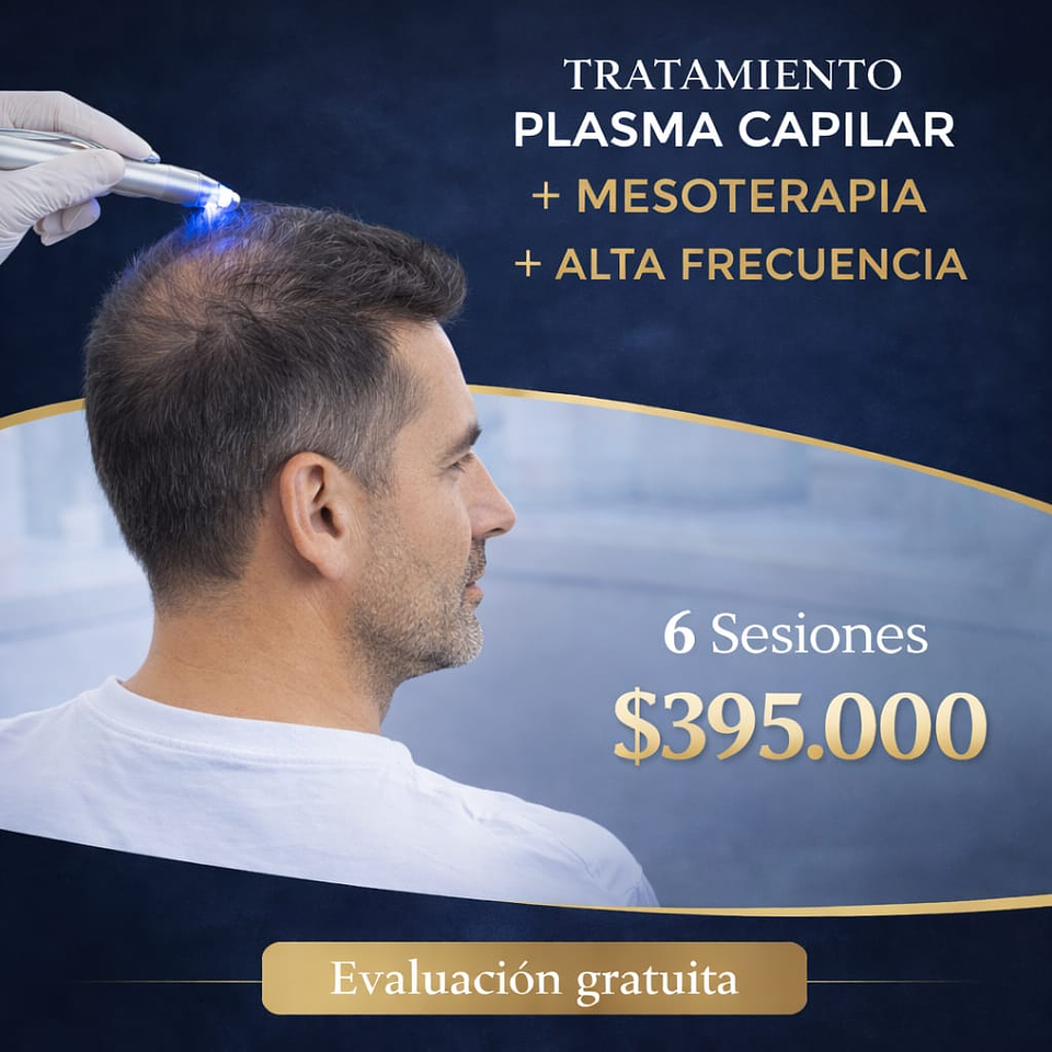 Tratamiento combinado con Mesoterapia Capilar  1