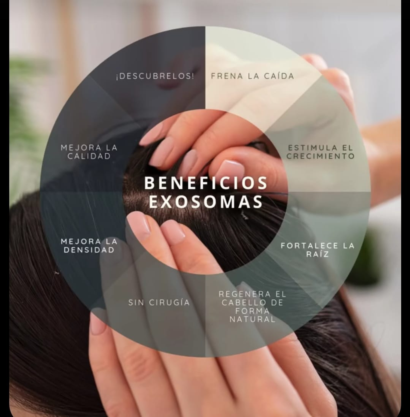 Tratamiento combinado con exosomas capilares  5