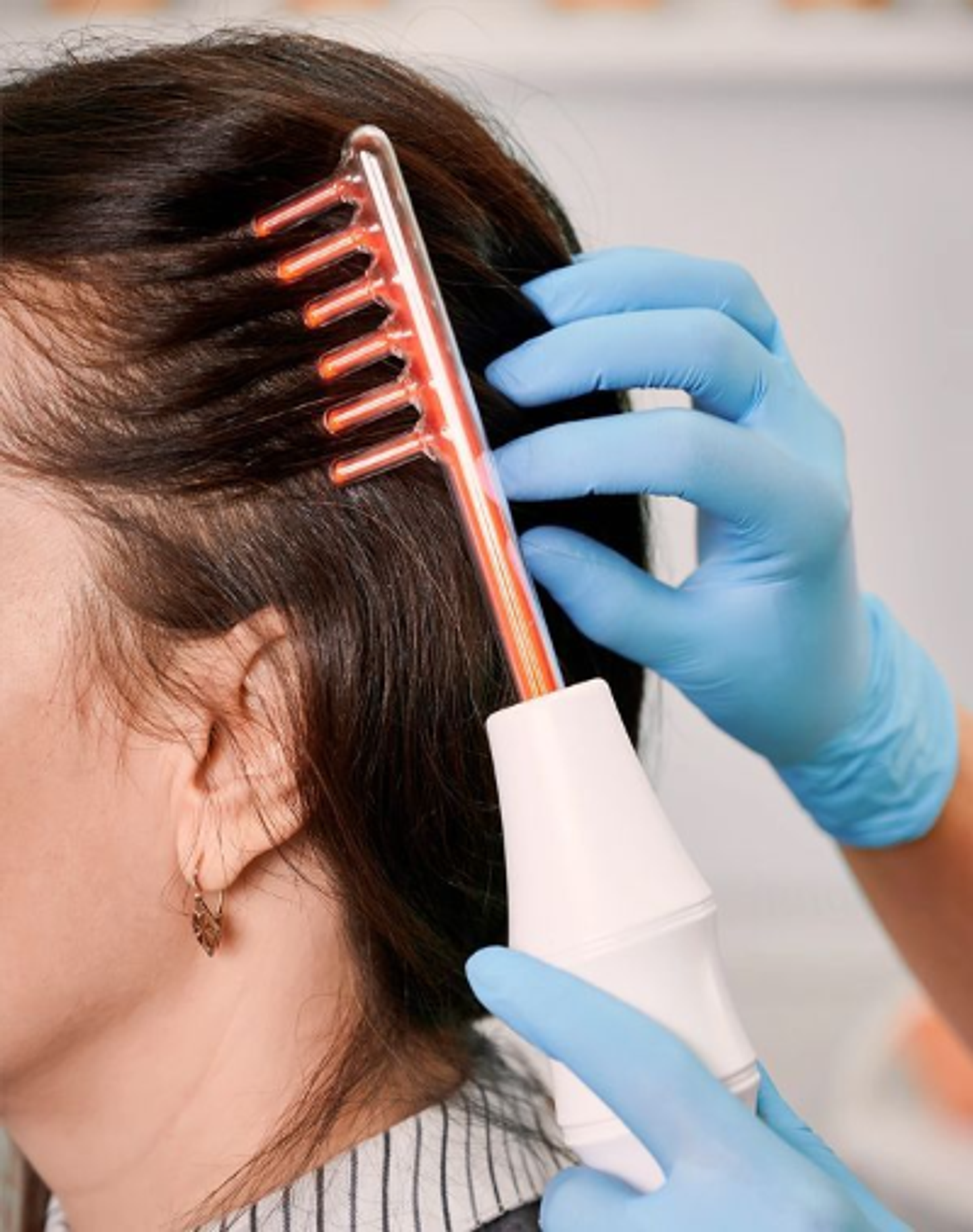 Radio Frecuencia Capilar 