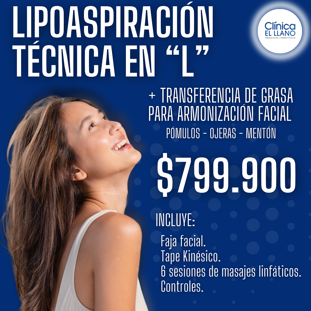 Lipoaspiración Técnica en " L "