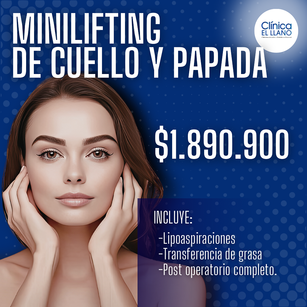 Minilifting de Cuello