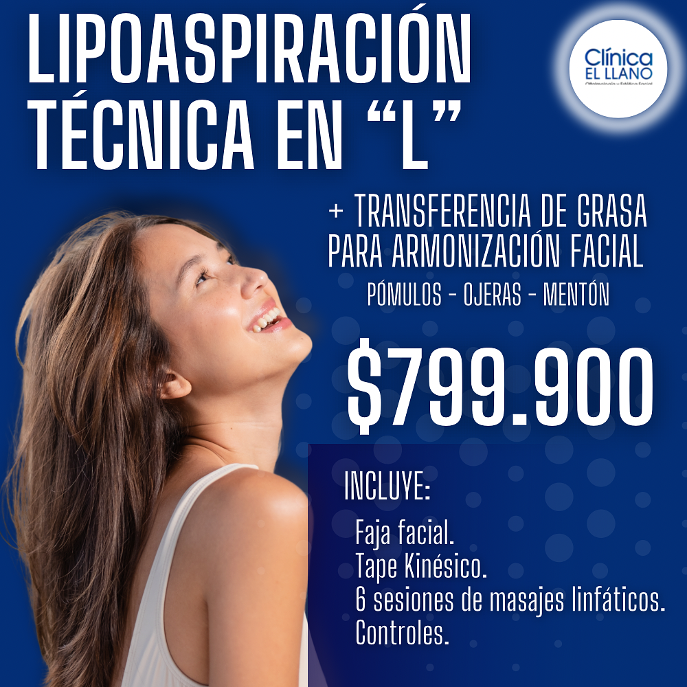 Lipoaspiración Técnica en “L”