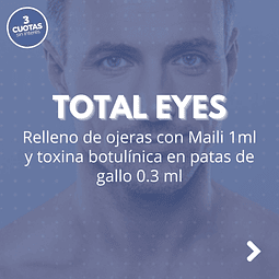 Total Eyes