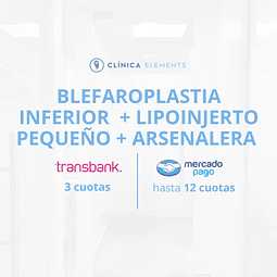 Blefaroplastia Inferior  + Lipoinjerto Pequeño + Arsenalera 