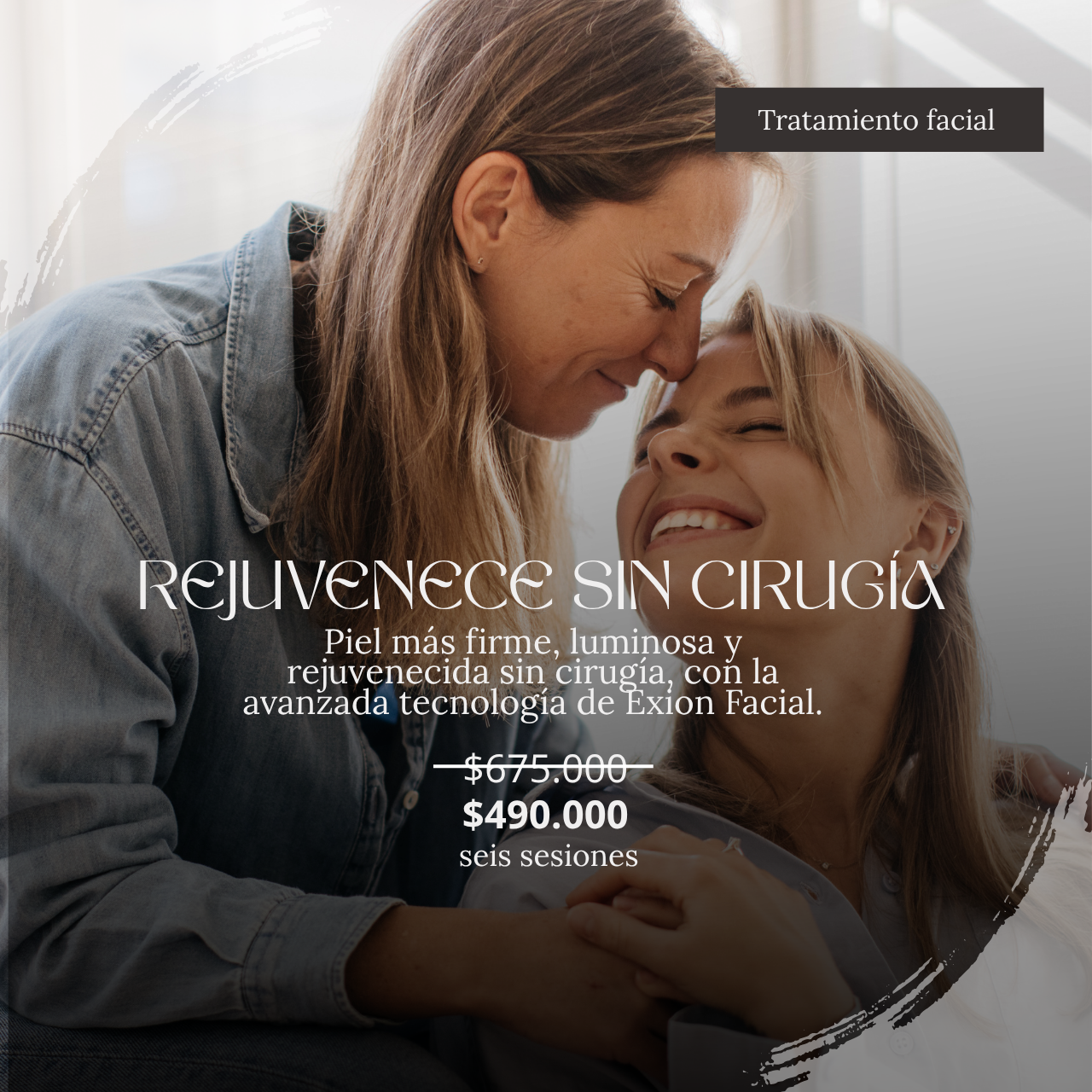 Tratamiento facial  Exion ( 6 sesiones)