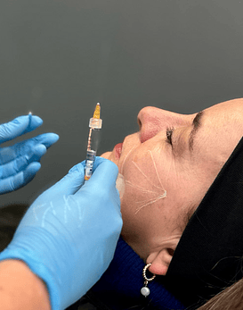 DermicBooster: Pack corrector de arrugas profundas y finas con Reage 3 zonas + Skinboosters (Hasta 2ml)