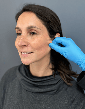 Bioestimulación de Colágeno con Radiesse + Mesoterapia Vitamina C rostro y cuello