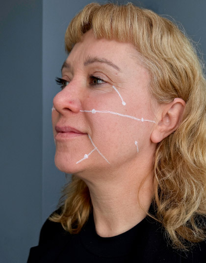 https://www.estetikamedica.cl/tratamientos-regenerativos-la-clave-de-la-firmeza-facial